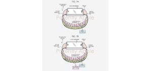 apple-watch-patente.jpg
